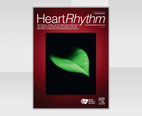 Heart Rhythm