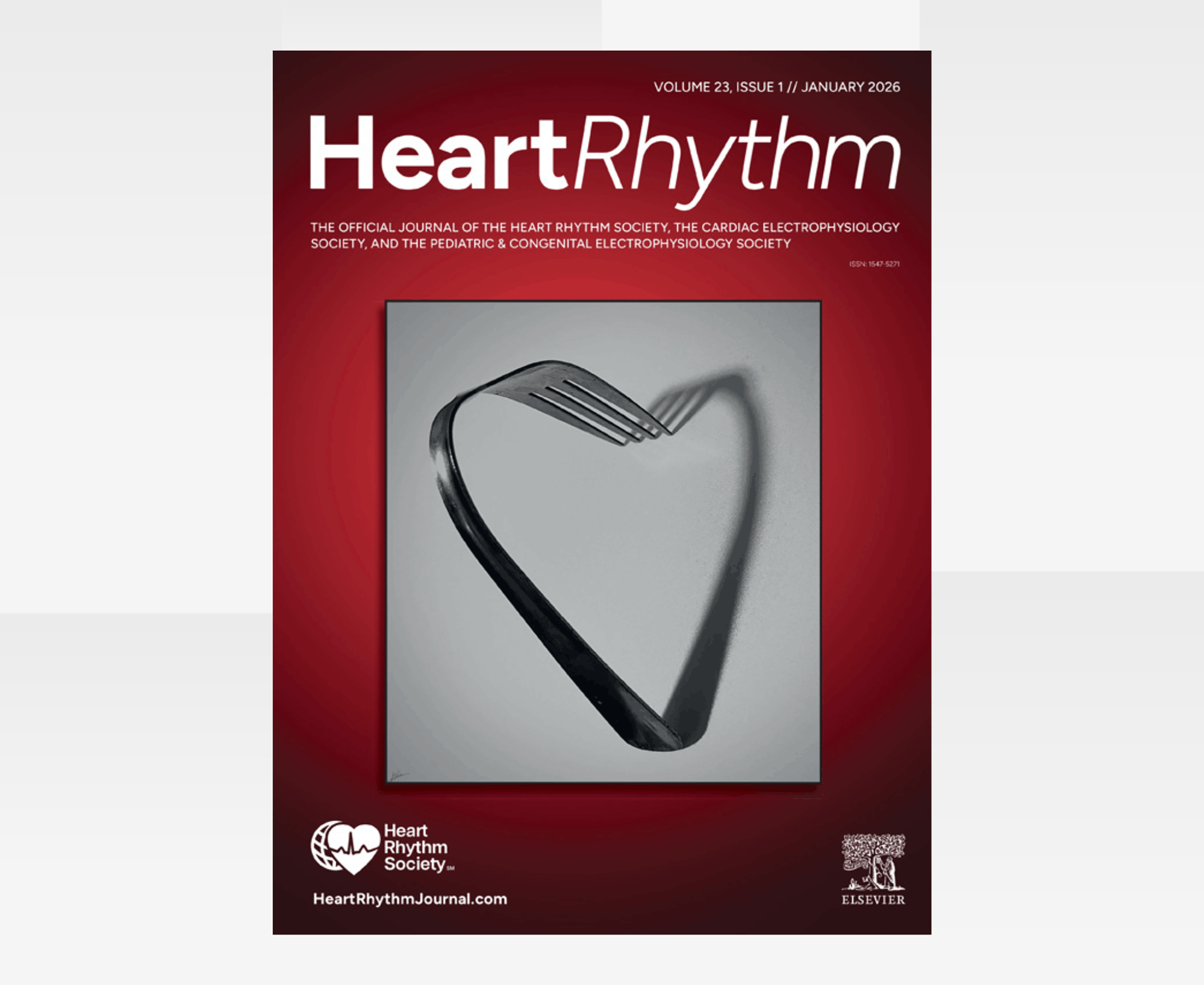 Heart Rhythm